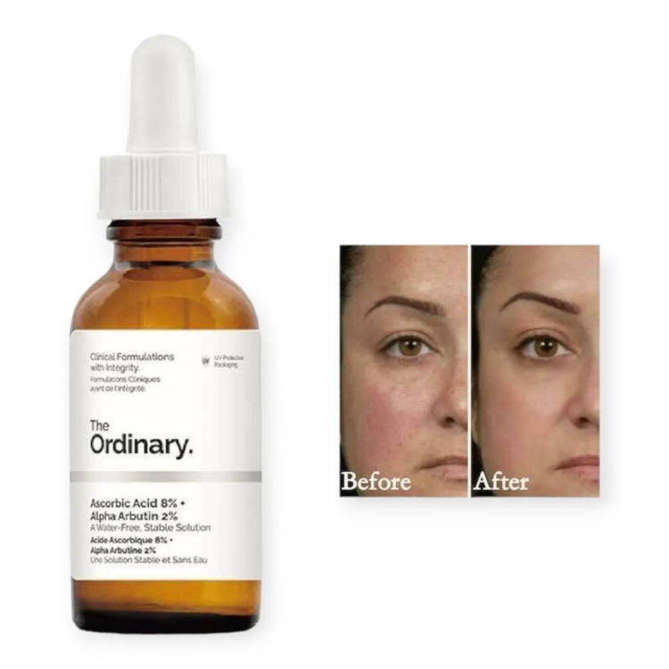 سرم آسکوربیک اسید 8درصد و آلفا آربوتین 2درصد اوردینری حجم 30 میل The Ordinary Ascorbic Acid 8 and Alpha Arbutin 2