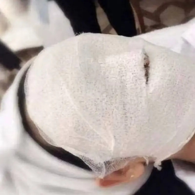 ماسک زاویه سازی صورت
