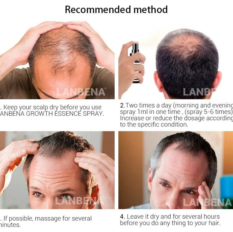 روغن مو قوی و مؤثر رشد و تقویت ریشه مو لانبنا
