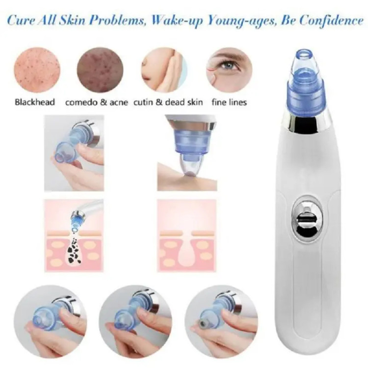 دستگاه میکرودرم آبریژن خانگی(DERMASUCTION)