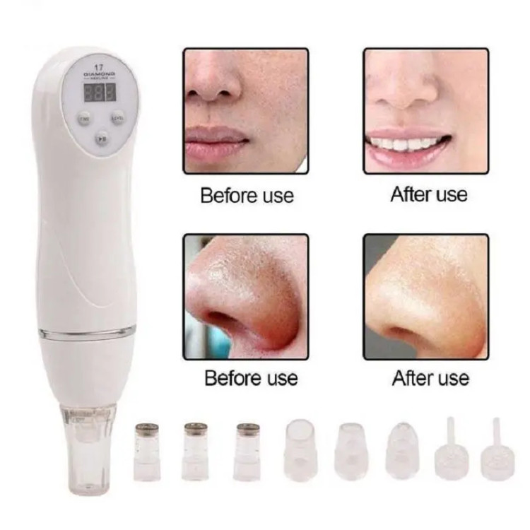 دستگاه میکرودرم دیاموند DIAMOND PEELING-17