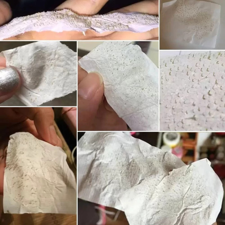 چسب بینی ضد جوش سرسیاه لانبنا